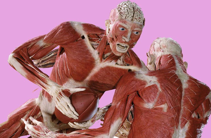 Dozens Of Human Corpses Are Coming To Auckland In Body Worlds Show!