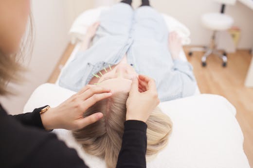 cosmetic acupuncture