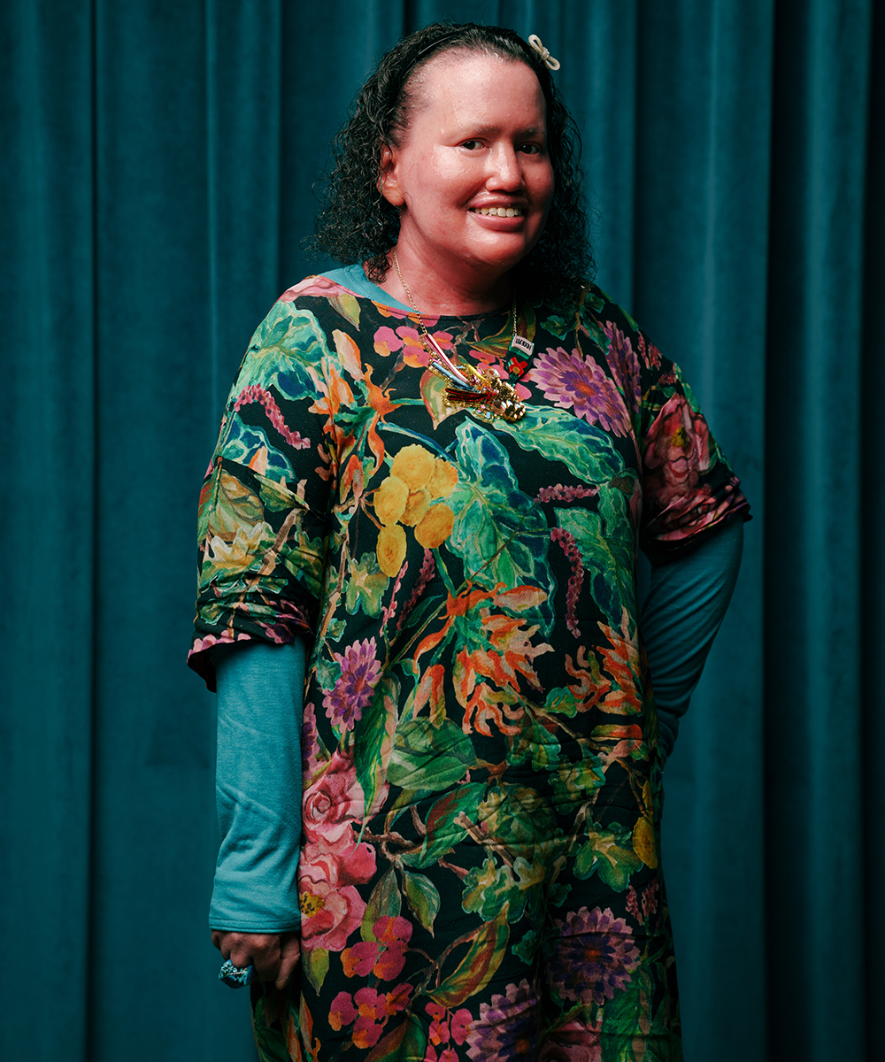 Writer Carly Findlay poses in a hand on her hip. She's smiling at the camera and is wearing a colourful dress over the top of a blue long sleeve shirt.